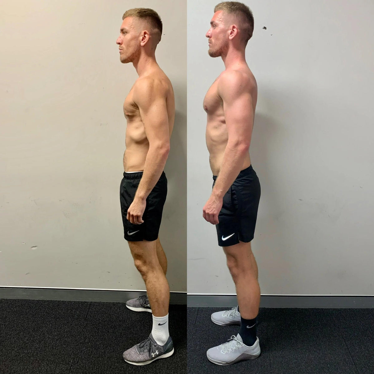 Trendizo24- Posture & Upper Back Support